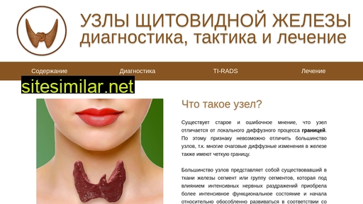 shitovidka-uzel.ru alternative sites