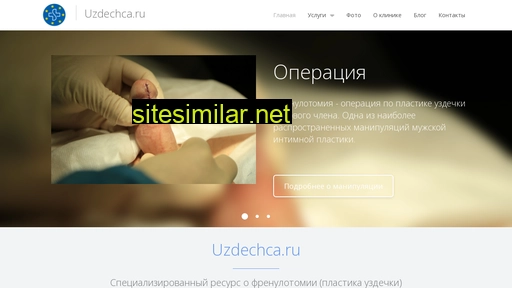 uzdechca.ru alternative sites