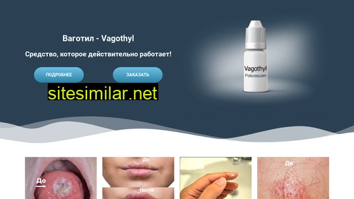 vagothyl.ru alternative sites