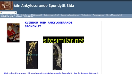 ankyloserande-spondylit.se alternative sites