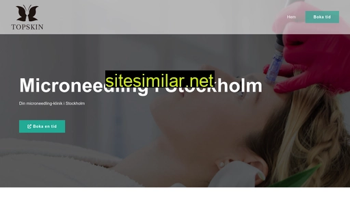 Stockholm-microneedling similar sites