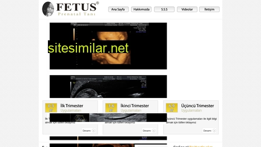 fetus.com.tr alternative sites
