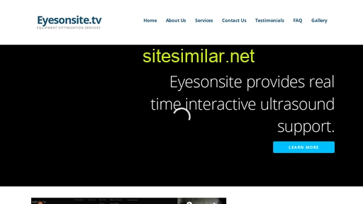eyesonsite.tv alternative sites
