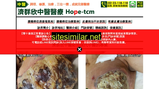 Hope-tcm similar sites